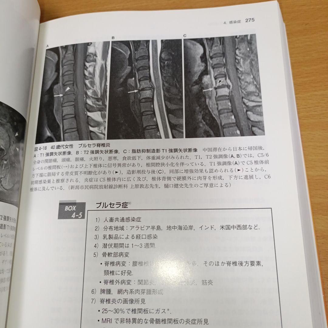 【名作運動器リハ】関節のMRI 第2版　画像理学療法作業療法リハビリ整形外科